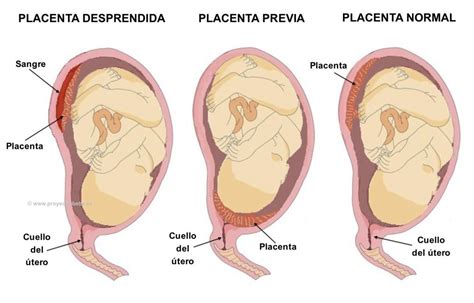 que es la placenta